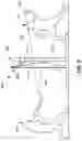 Fig. 17 - Anti-Bounce Back Protective Safety Screen Systems