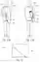 Fig. 08 - Yoga mat carriers