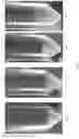 Fig. 07 - Process and method for the recovery of oil from the processing of grains into biofuels and other chemicals