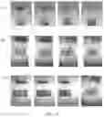 Fig. 16 - Immunodetection Method