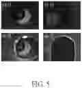 Fig. 06 - Device for sorting bio-particles using image-manipulated electric force and operating method thereof