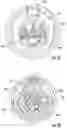 Fig. 09 - Multi-function sprayhead