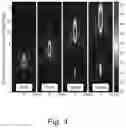 Fig. 07 - Focused ultrasound transducer with electrically controllable focal length