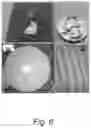 Fig. 09 - Focused ultrasound transducer with electrically controllable focal length