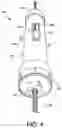Fig. 04 - High-pressure water debridement system