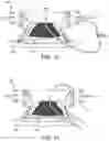 Fig. 08 - High-pressure water debridement system