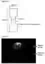 Fig. 20 - Blank, formed article, die assembly, and method for producing blank