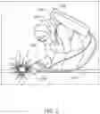 Fig. 04 - PORTABLE AND COMPACT WELDING FUME EXTRACTOR
