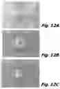 Fig. 14 - Inert gas-assisted laser machining of ceramic-containing articles