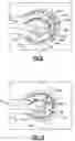 Fig. 04 - Abrasive flow machining method and article