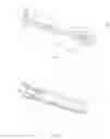 Fig. 02 - Nailing unit and nail gun comprising said nailing unit