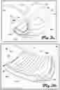 Fig. 04 - Pneumatic exomuscle system and method