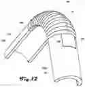 Fig. 13 - Pneumatic exomuscle system and method