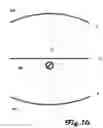 Fig. 17 - Pneumatic exomuscle system and method