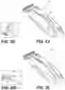 Fig. 06 - Shaver handle and methods of use