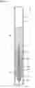 Fig. 14 - Applicator with gas-liquid exchanging section and occluding body
