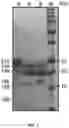 Fig. 02 - Quality protein maize based on increased sulfur reduction in leaf cells