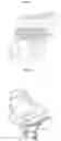 Fig. 02 - Air cleaner for vehicle