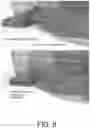 Fig. 07 - Quick-detach handguard locking system