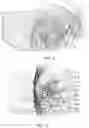Fig. 06 - Fetal ultrasound image processing