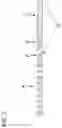 Fig. 03 - Method for manufacturing an endoscope insertion tube, and endoscope having an insertion tube