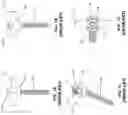 Fig. 02 - Poly-axial implant fixation system