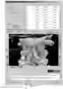 Fig. 04 - Robotic system and method for spinal and other surgeries