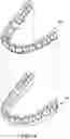 Fig. 04 - Multilayer sheet structure for dental appliance