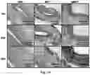 Fig. 17 - Bioerodible wraps and uses therefor