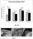 Fig. 25 - Bioerodible wraps and uses therefor