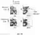 Fig. 112 - Methods for treating hair loss disorders