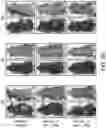 Fig. 133 - Methods for treating hair loss disorders