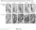 Fig. 40 - Methods for treating hair loss disorders