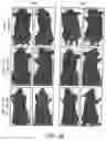 Fig. 48 - Methods for treating hair loss disorders