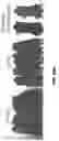 Fig. 75 - Methods for treating hair loss disorders