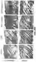 Fig. 77 - Methods for treating hair loss disorders