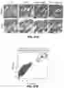 Fig. 81 - Methods for treating hair loss disorders