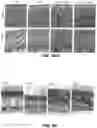 Fig. 94 - Methods for treating hair loss disorders