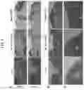 Fig. 04 - PLURIPOTENT STEM CELLS INDUCING OSTEOCHONDRAL REPAIR
