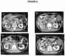 Fig. 07 - Methods and Compositions Useful for Treating Cancer
