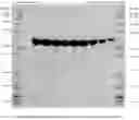 Fig. 18 - STERILIZABLE PRE-FILLED PHARMACEUTICAL PACKAGES COMPRISING A LIQUID FORMULATION OF A VEGF-ANTAGONIST