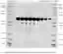 Fig. 19 - STERILIZABLE PRE-FILLED PHARMACEUTICAL PACKAGES COMPRISING A LIQUID FORMULATION OF A VEGF-ANTAGONIST