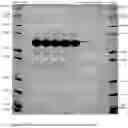 Fig. 20 - STERILIZABLE PRE-FILLED PHARMACEUTICAL PACKAGES COMPRISING A LIQUID FORMULATION OF A VEGF-ANTAGONIST