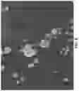 Fig. 07 - Tooth and bone restoration via plasma deposition