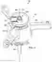 Fig. 07 - Rotor hub vibration attenuator