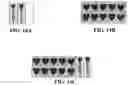 Fig. 15 - Apparatus and method for distinguishing containers