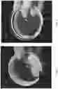 Fig. 02 - CONTAINER CAP WITH GLASS IMPLEMENT