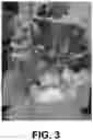 Fig. 04 - Storage stable choline chloride compositions