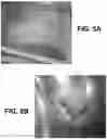 Fig. 06 - Storage stable choline chloride compositions