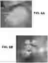 Fig. 07 - Storage stable choline chloride compositions